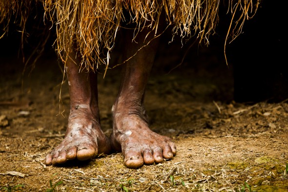 Feet of Yagua Tribal Member in Peruvian Amazon